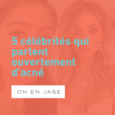 5 célébrités qui ont parlé ouvertement de leurs problèmes d’acné